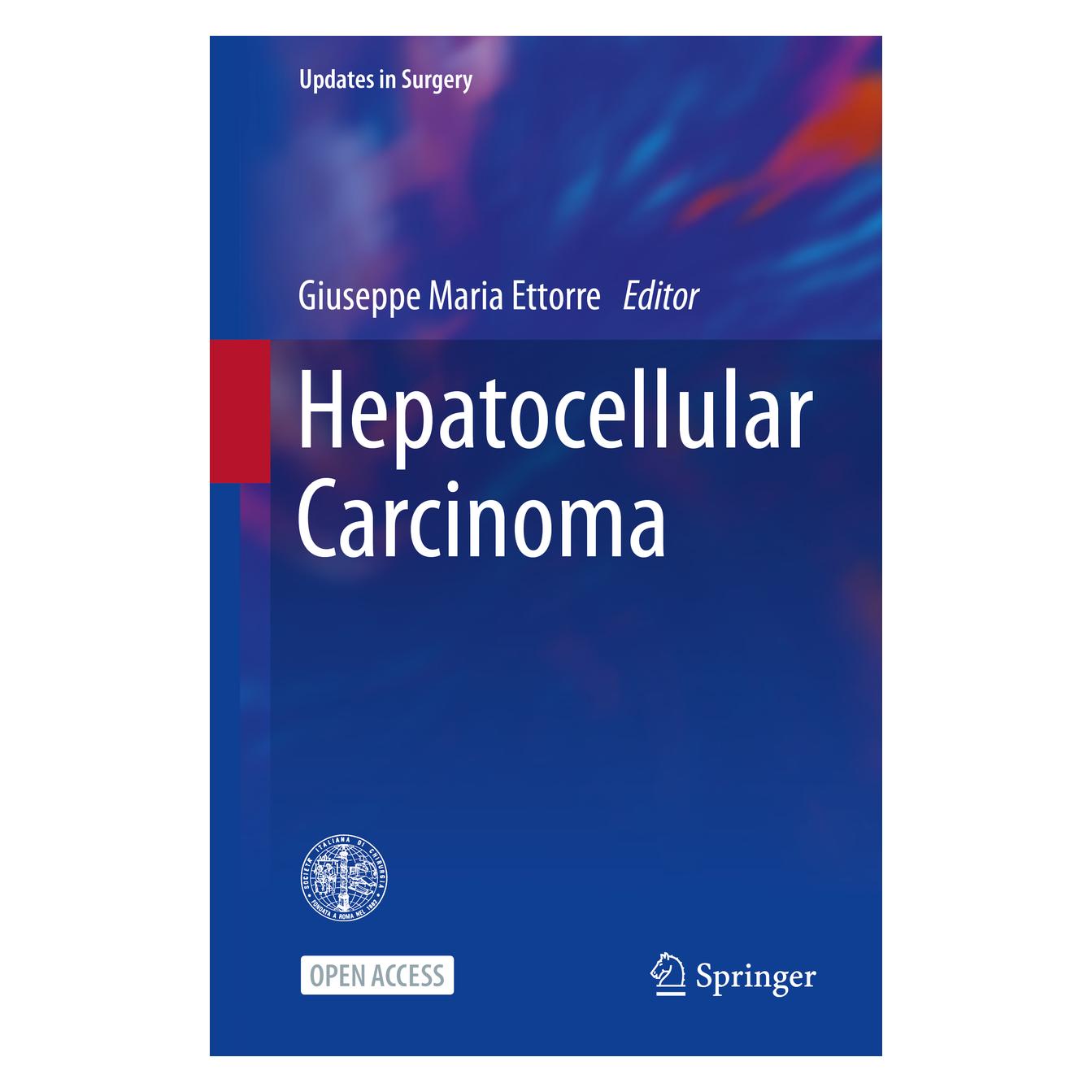 Springer Hepatocellular Carcinoma (Englisch, Softcover, Giuseppe Maria Ettorre) (56852631)