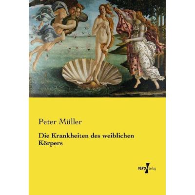 Die Krankheiten des weiblichen Körpers, Taschenbuch von Peter Müller, Vero Verlag, 978-3-7372-1477-3