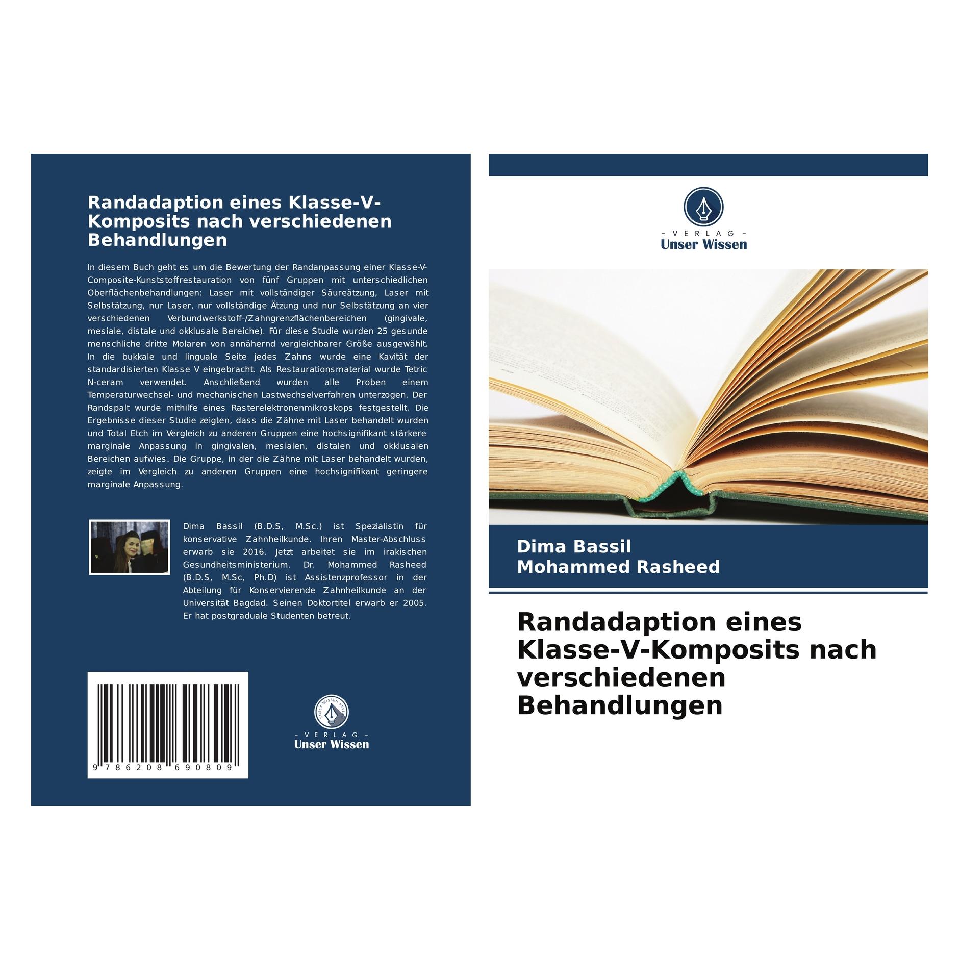 Bod Randadaption eines Klasse-V-Komposits nach verschiedenen Behandlungen (Deutsch, Dima Bassil, Mohammed Rasheed, 2025) (57212894)