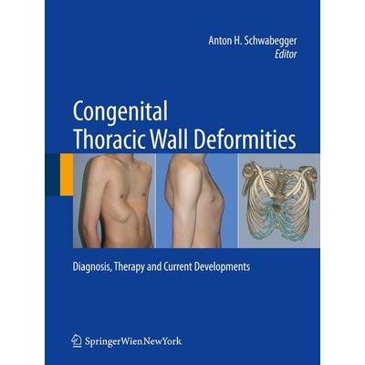 Congenital Thoracic Wall Deformities, Gebundene Ausgabe von Anton Schwabegger, Springer Wien, 978-3-211-99137-4