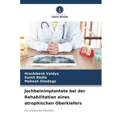 Jochbeinimplantate bei der Rehabilitation eines atrophischen Oberkiefers, Taschenbuch von Hrashikesh Vaidya,Sumit Bedia,Mahesh Ghadage, Verlag Unser