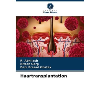 Haartransplantation, Taschenbuch von R. Abhilash,Ritesh Garg,Debi Prasad Ghatak, Verlag Unser Wissen, 978-620-6-99493-0