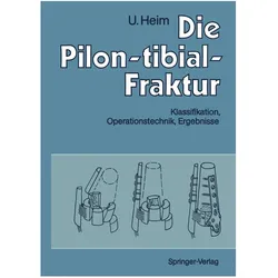 Die Pilon-tibial-Fraktur, Fachbücher von Urs Heim