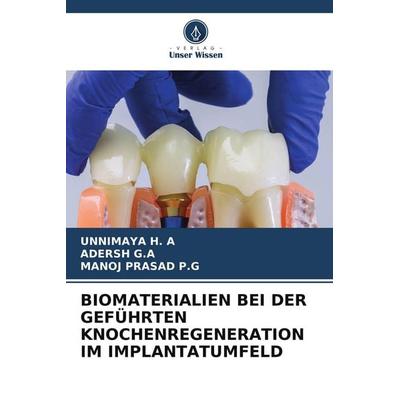 BIOMATERIALIEN BEI DER GEFÜHRTEN KNOCHENREGENERATION IM IMPLANTATUMFELD, Taschenbuch von Unnimaya H. A.,Adersh G. A.,Manoj Prasad P. G., Verlag Unser