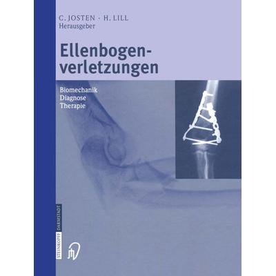 Ellenbogenverletzungen, Taschenbuch von , Steinkopff, 978-3-642-63311-9