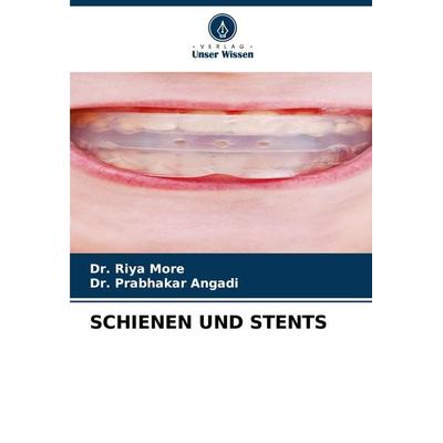SCHIENEN UND STENTS, Taschenbuch von Riya More,Prabhakar Angadi, Verlag Unser Wissen, 978-620-7-77969-7