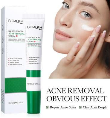 Uplifted Trends Salicylic Acid Acne Treatment Cream Moisturizing & Firming Face Cream For Acne Marks & Blackheads Salicylic Acid Acne Treatment Cream Moisturizing & Firming Face Cream For Acne Marks & Blackheads