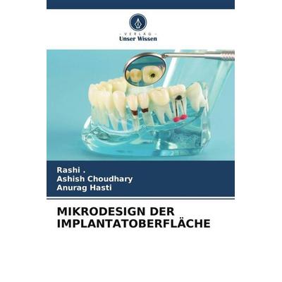 MIKRODESIGN DER IMPLANTATOBERFLÄCHE, Taschenbuch von Rashi,Ashish Choudhary,Anurag Hasti, Verlag Unser Wissen, 978-620-5-15109-9