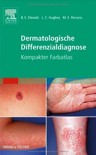 Elewski, Boni E. - Dermatologische Differenzialdiagnose: Kompakter Farbatlas - Preis vom 30.09.2026 09:01:18 h