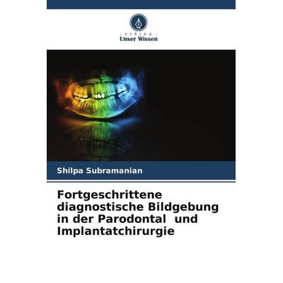 Fortgeschrittene diagnostische Bildgebung in der Parodontal und Implantatchirurgie, Taschenbuch von Shilpa Subramanian, Verlag Unser Wissen,