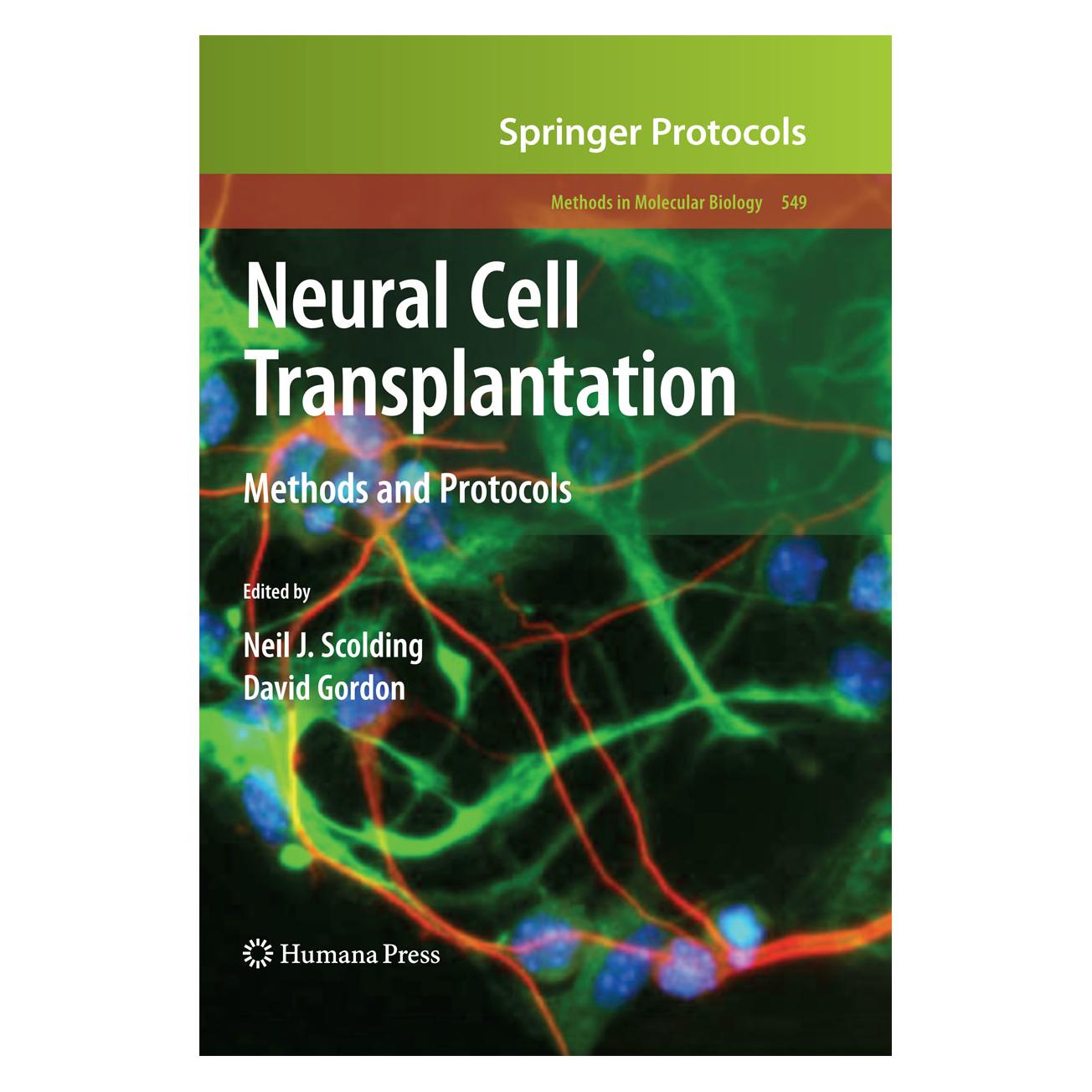 Springer Neural Cell Transplantation (Englisch, Softcover, David Gordon, Neil J. Scolding) (55402533)