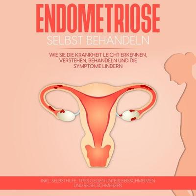 Endometriose selbst behandeln: Wie Sie die Krankheit leicht erkennen, verstehen, behandeln und die Symptome lindern - inkl. Selbsthilfe-Tipps gegen