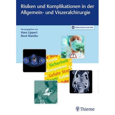 Risiken und Komplikationen in der Allgemein- und Viszeralchirurgie, Set von , Thieme, 978-3-13-169811-7