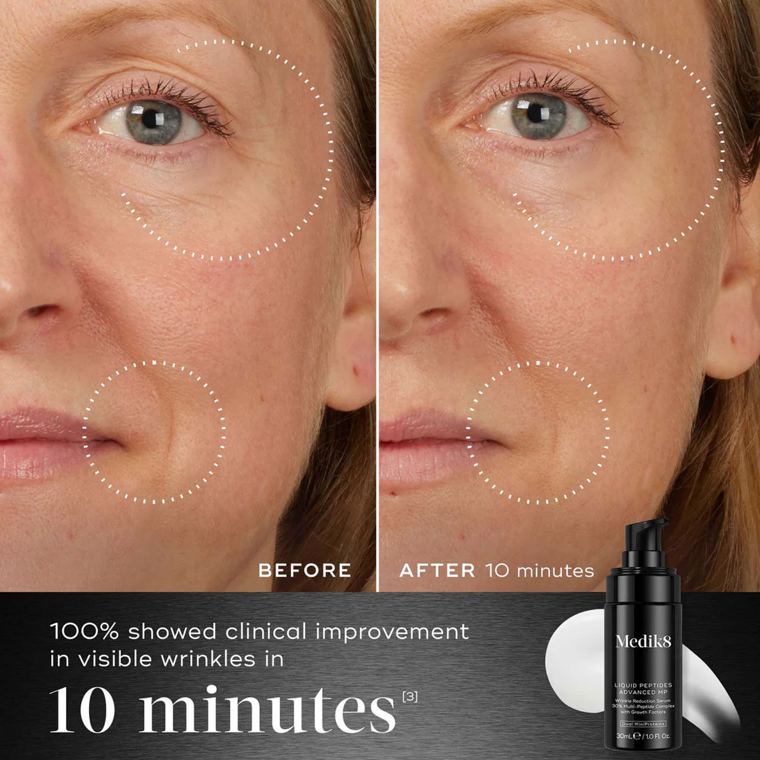 MEDIK8 Liquid Peptides Advanced MP Serum 30ml