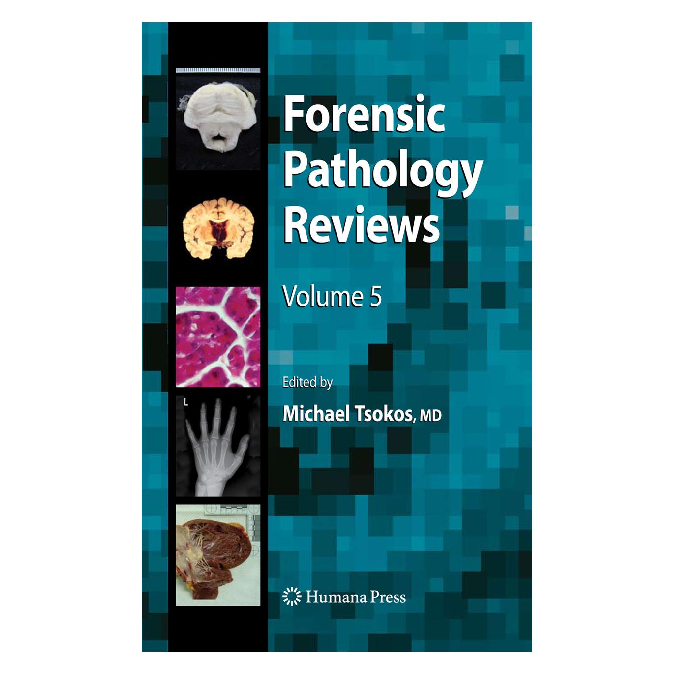 Springer Forensic Pathology Reviews 5 (Englisch, Softcover, Michael Tsokos) (55382001)