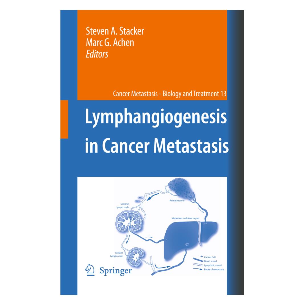 Springer Lymphangiogenesis in Cancer Metastasis (Englisch, Softcover, Marc G. Achen, Steven A. Stacker) (55419493)