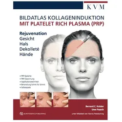 Bildatlas Platelet Rich Plasma (PRP), Fachbücher von Bernard C. Kolster, Uwe Paasch