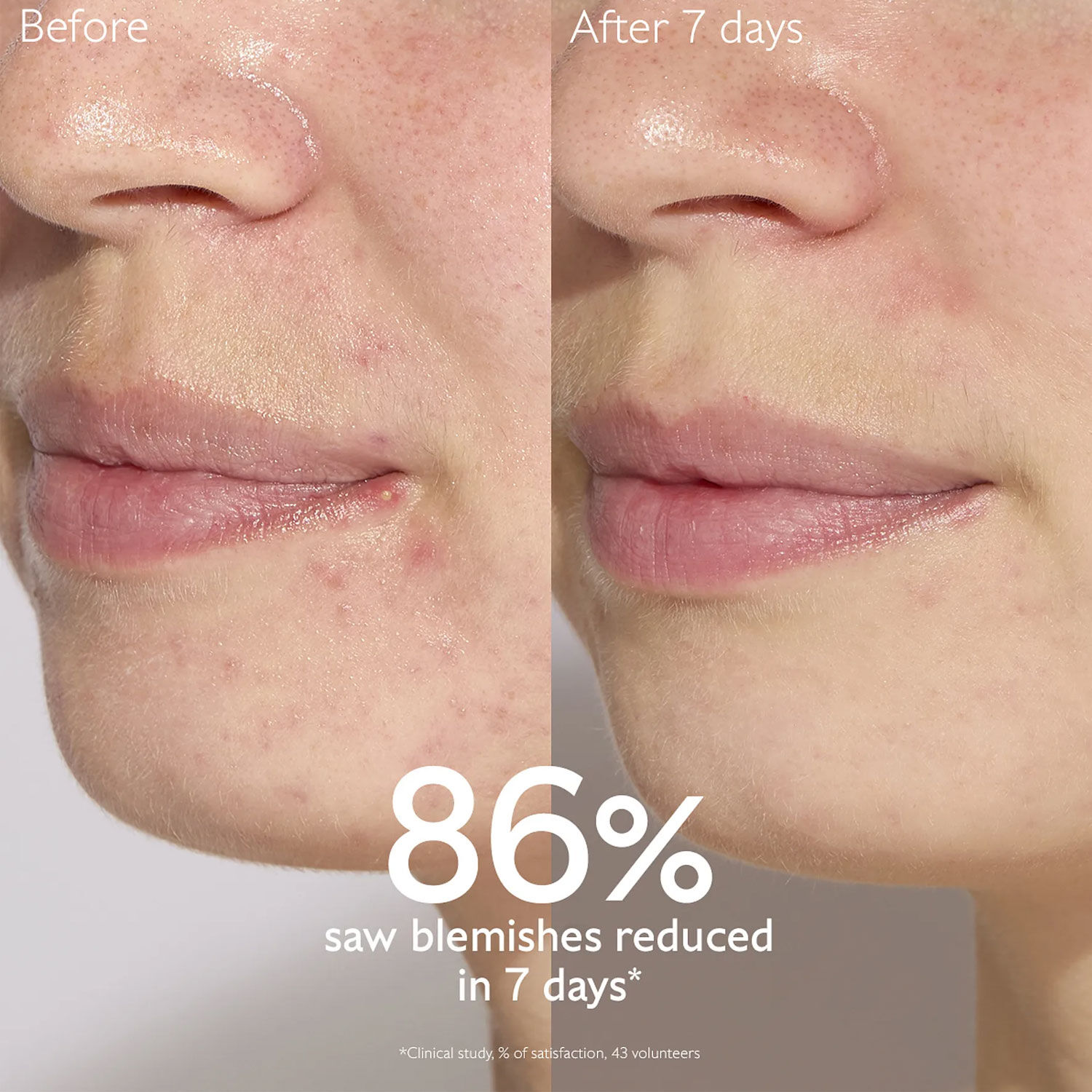 CAUDALIE Vinopure Blemish Control Salicylic Serum 30ml