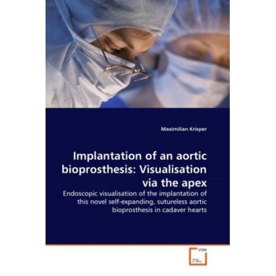 Krisper, M: Implantation of an aortic bioprosthesis: Visuali, Taschenbuch von Maximilian Krisper, VDM, 978-3-639-29612-9