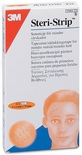3M Steri Strip Fita Sutura 6mm X 75mm