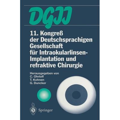 11. Kongreß der Deutschsprachigen Gesellschaft für Intraokularlinsen-Implantation und refraktive Chirurgie, Taschenbuch von , Springer Berlin,