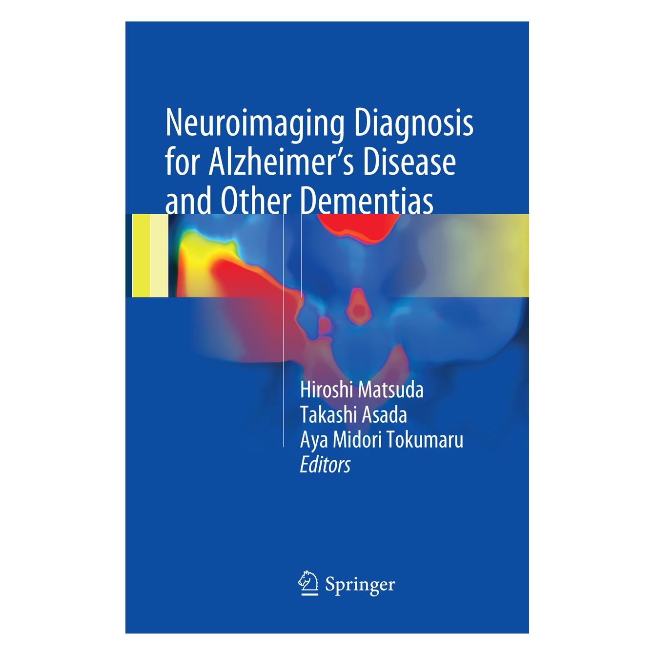 Springer Neuroimaging Diagnosis for Alzheimer's Disease and Other Dementias (Englisch, Softcover, Aya Tokumaru, Hiroshi Matsuda, Midori Tokumaru, Takashi Asada) (56051262)