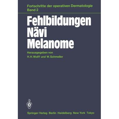 Fehlbildungen Nävi Melanome, Taschenbuch von , Springer Berlin, 978-3-540-15713-7
