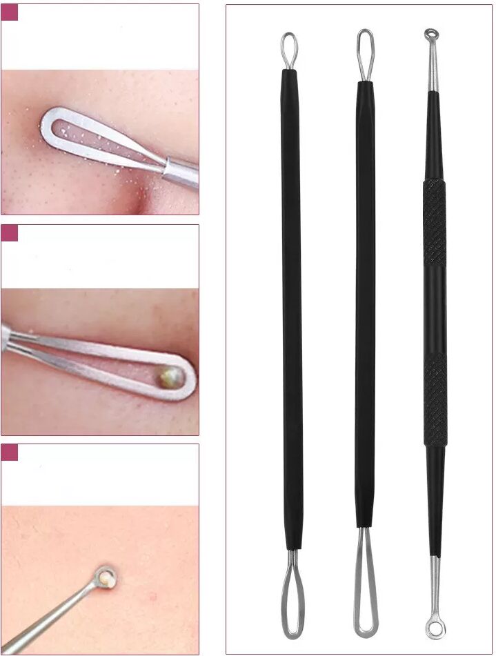 INF 5er-Pack Mitesser-Entferner-Akne-Nadel-Werkzeugset