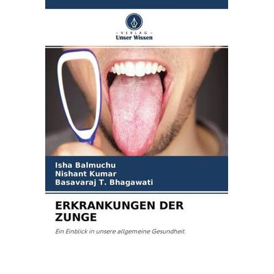 ERKRANKUNGEN DER ZUNGE, Taschenbuch von Isha Balmuchu,Nishant Kumar,Basavaraj T. Bhagawati, Verlag Unser Wissen, 978-620-4-62247-7