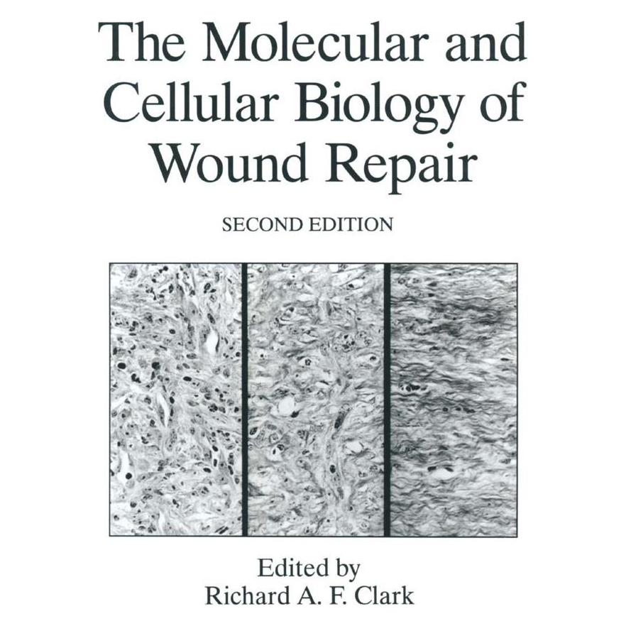 Springer The Molecular and Cellular Biology of Wound Repair (Englisch, Softcover, Richard A. F. Clark) (55539611)