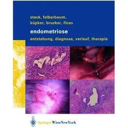 Endometriose, Fachbücher von Thomas Steck, Dominique F. Finas, Cosima Brucker, Wolfgang Küpker, Ricardo E Felberbaum