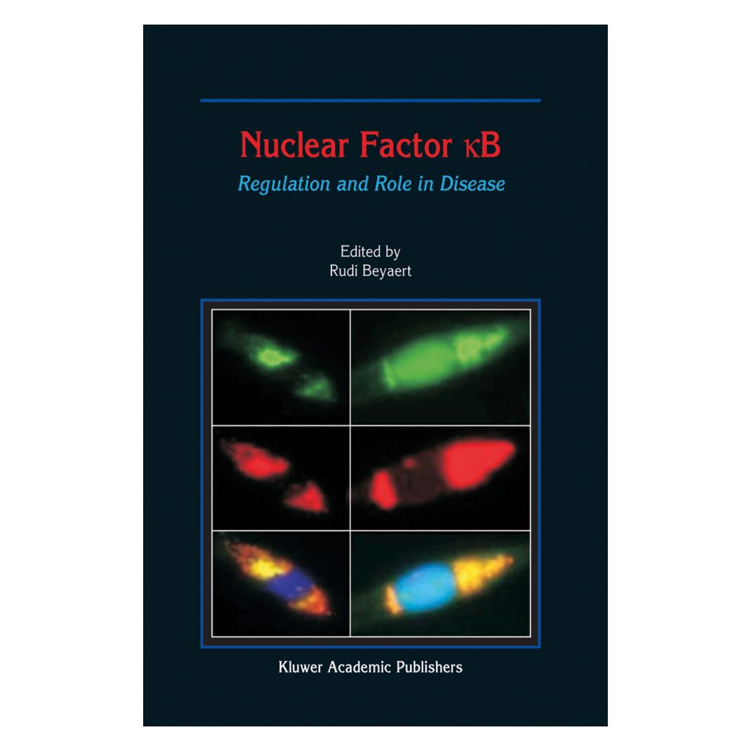 Springer Nuclear Factor B (Englisch, Softcover, R. Beyaert) (55532123)