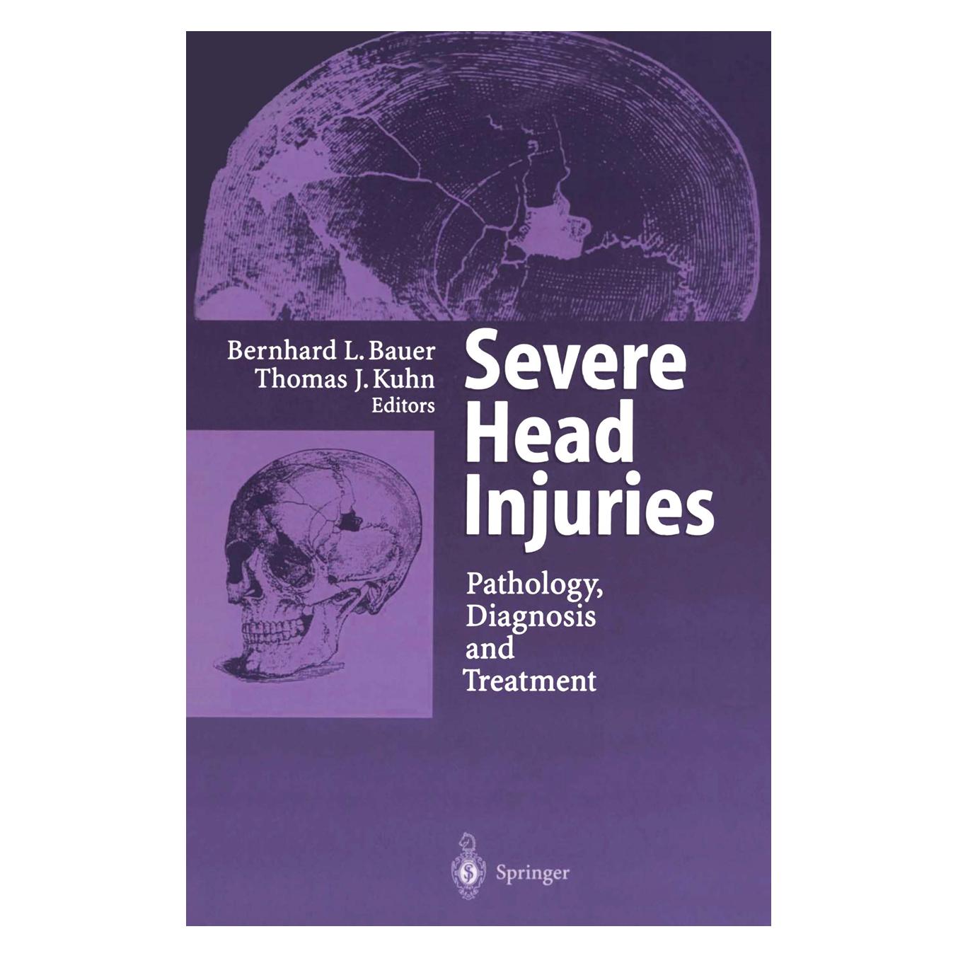 Springer Severe Head Injuries (Englisch, Softcover, Bernhard L. Bauer, Thomas J. Kuhn) (55507016)