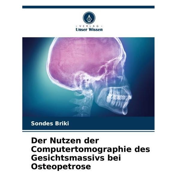 Umbreit Der Nutzen der Computertomographie des Gesichtsmassivs bei Osteopetrose (Deutsch, Softcover, Sondes Briki) (69112063)