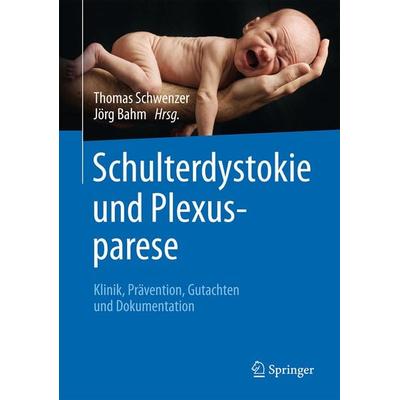 Schulterdystokie und Plexusparese, Gebundene Ausgabe von , Springer Berlin, 978-3-662-48786-0