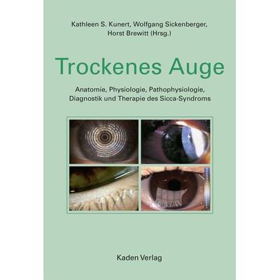 Trockenes Auge, Gebundene Ausgabe von , Kaden, R, 978-3-942825-48-1