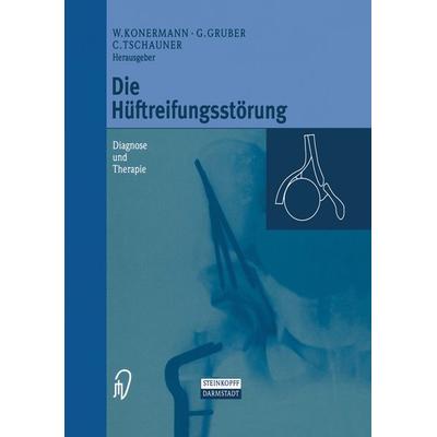 Die Hüftreifungsstörung, Taschenbuch von , Steinkopff, 978-3-642-63687-5