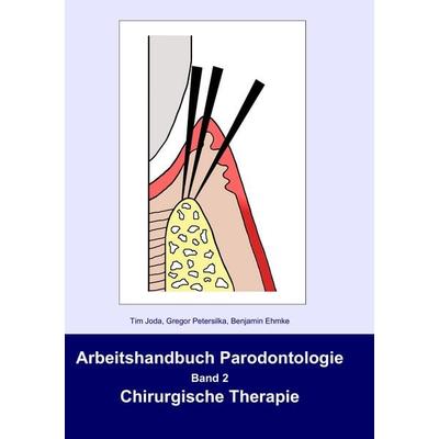 Arbeitshandbuch Parodontologie, Taschenbuch von Tim Joda,Gregor Petersilka,Benjamin Ehmke, BoD – Books on Demand, 978-3-8370-4635-9