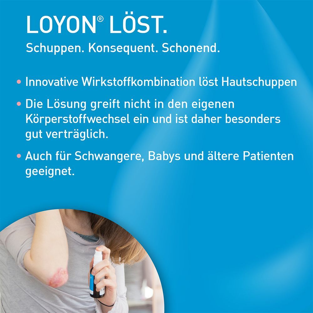 Loyon bei Schuppenflechte, Milchschorf und Kopfgneis Lösung 50 ml 50 ml Lösung