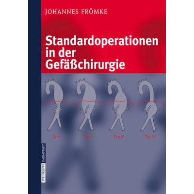 Standardoperationen in der Gefäßchirurgie, Gebundene Ausgabe von Johannes Frömke, Steinkopff, 978-3-7985-1460-7
