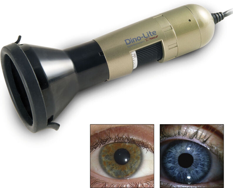 Iriscopio Dino-Lite: Permite criar facilmente imagens nítidas dos olhos e os íris