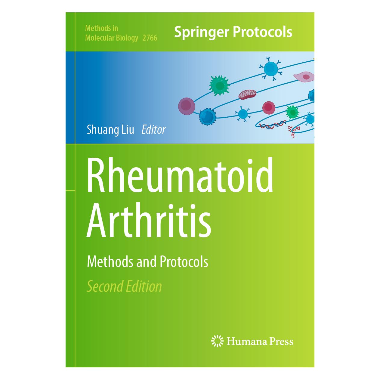 Springer Rheumatoid Arthritis (Englisch) (57201533)