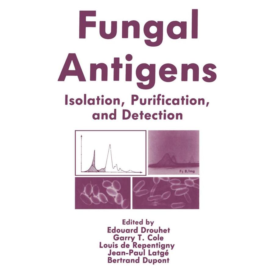Springer Fungal Antigens (Englisch, Softcover, Edouard Drouhet, Garry T Cole, Garry T. Cole, Jean Latge, Louis De Repentigny, Louis et al De Repentigny) (55550640)
