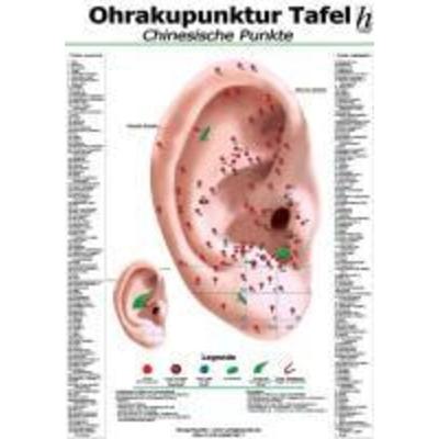 Ohrakupunktur-Tafel - chinesische Punkte, Sonstige von , Hawelka, Verlag, 978-3-86957-061-7