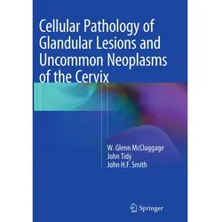 Cellular Pathology of Glandular Lesions and Uncommon Neoplasms of the Cervix, Fachbücher von John Smith, Glenn McCluggage, John Tidy