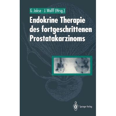 Endokrine Therapie des fortgeschrittenen Prostatakarzinoms, Taschenbuch von , Springer Berlin, 978-3-642-76867-5