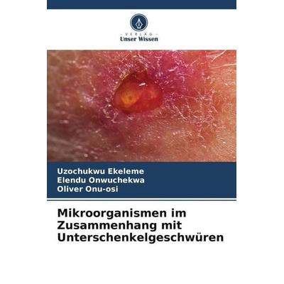 Mikroorganismen im Zusammenhang mit Unterschenkelgeschwüren, Taschenbuch von Uzochukwu Ekeleme,Elendu Onwuchekwa,Oliver Onu-osi, Verlag Unser Wissen,