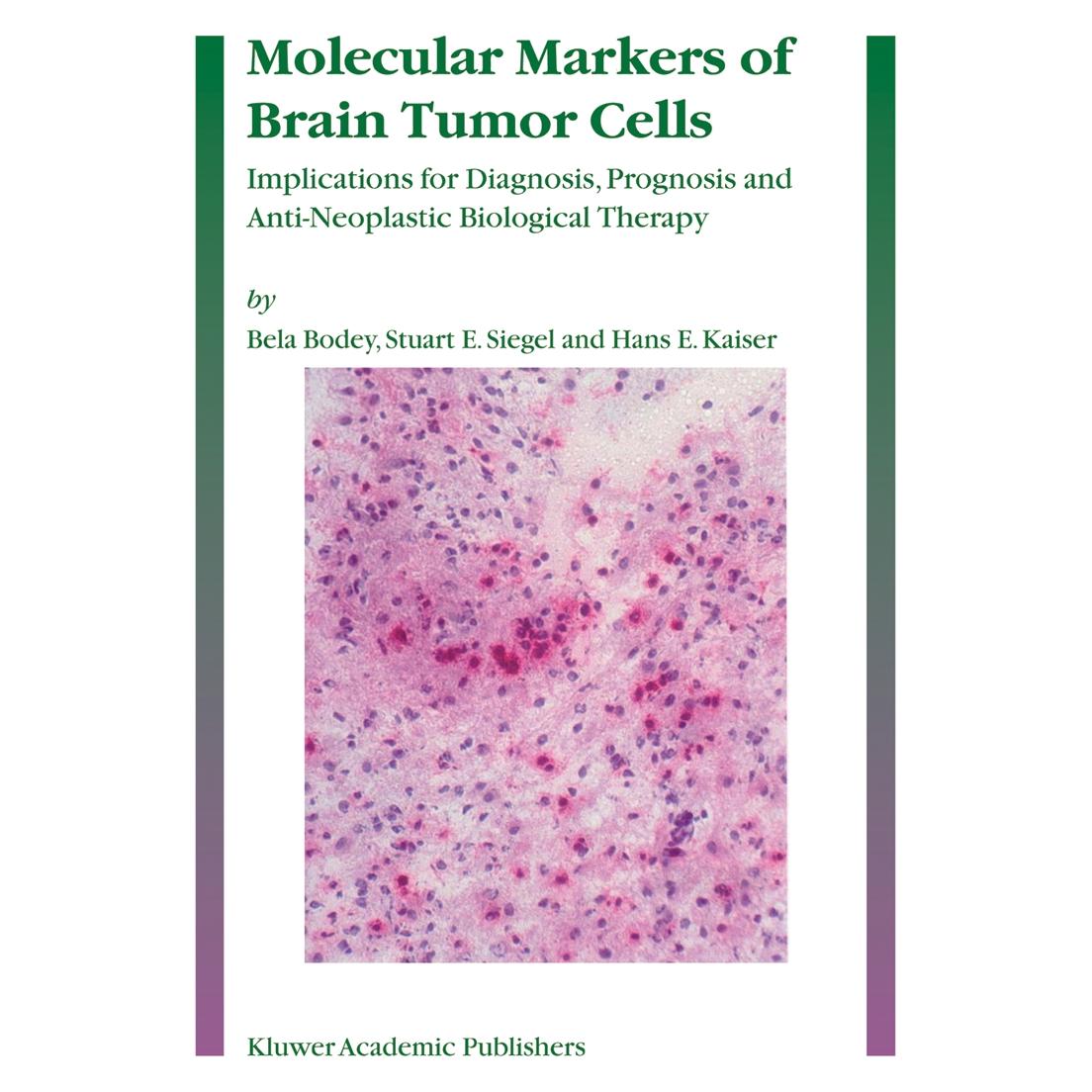 Springer Molecular Markers of Brain Tumor Cells (Englisch, Softcover, Bela Bodey, Hans E Kaiser, Stuart E Siegel) (55378562)