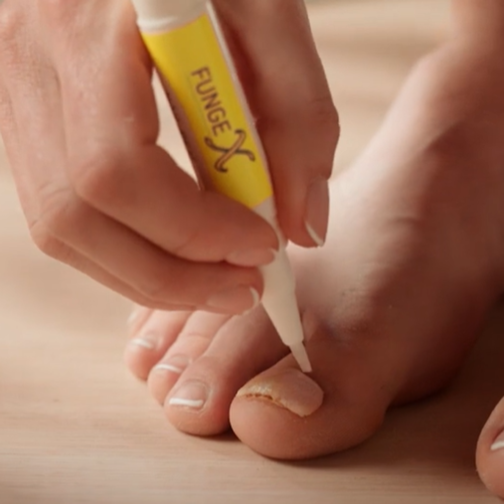 FungeX Nail Repair Pen for Hands and Feet 3mL