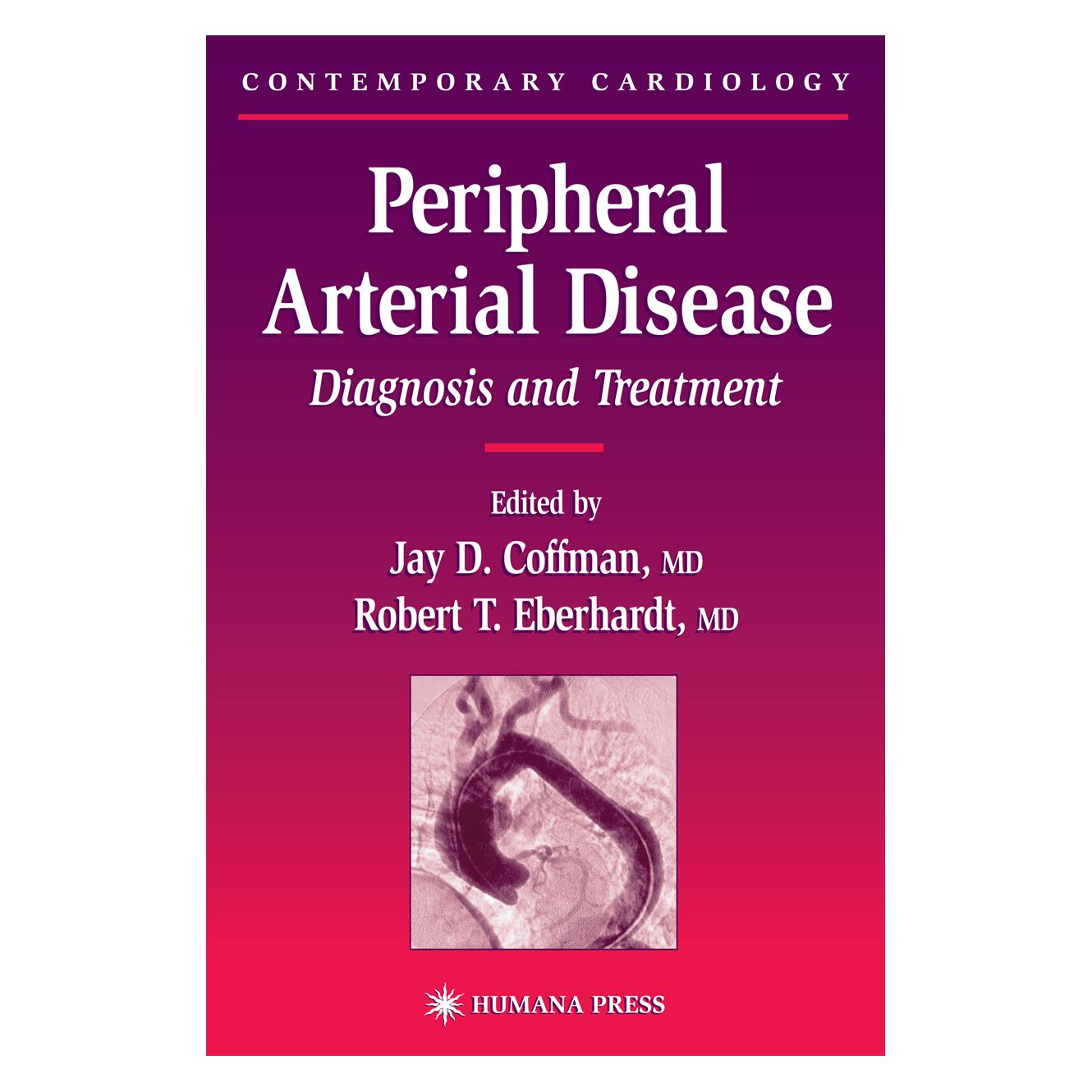 Springer Peripheral Arterial Disease (Englisch, Softcover, Jay D. Coffman, Robert T. Eberhardt) (55382839)